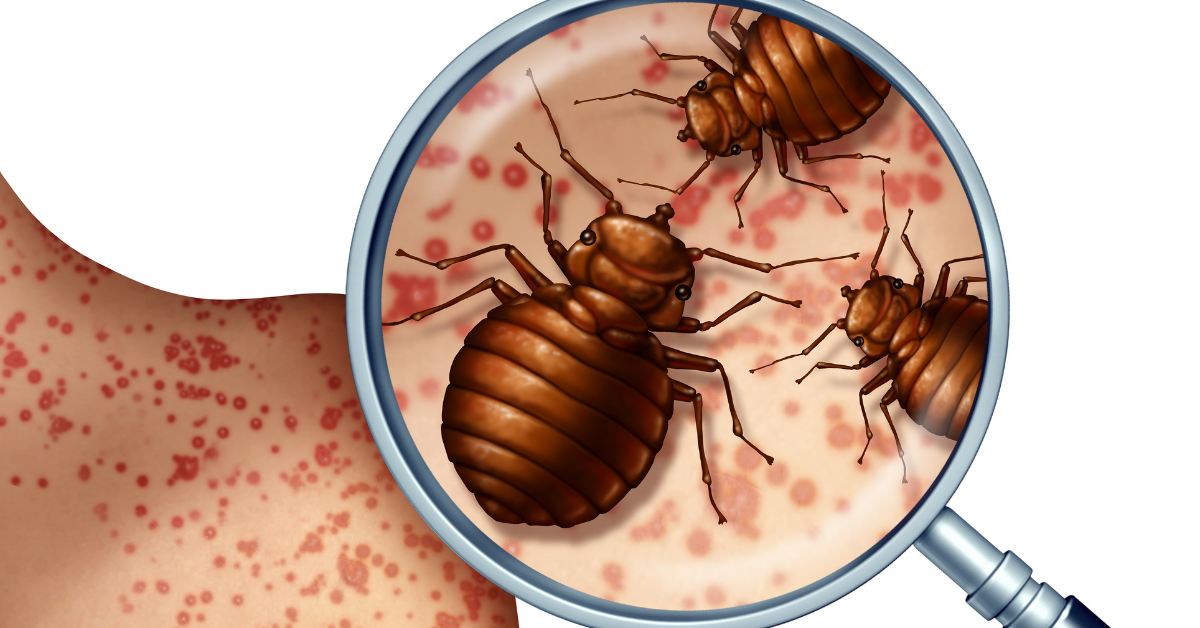Funny Responses To Dont Let The Bedbugs Bite - Guide